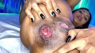 flexi milf prolapse her anus while she gets ass fucked